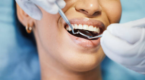 Dentist for Dental Trauma in WA